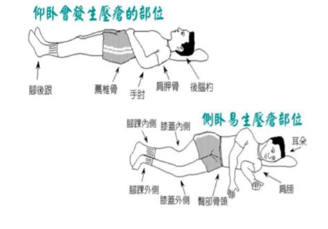 翻身擺位|翻身擺位